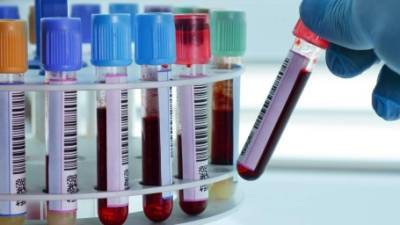 La prueba mide la proporción de dos proteínas que hay en la sangre.