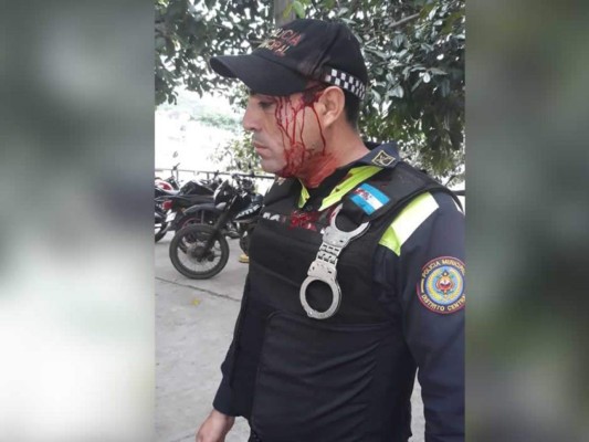 Hieren a un policía municipal en turba de vendedores en Tegucigalpa