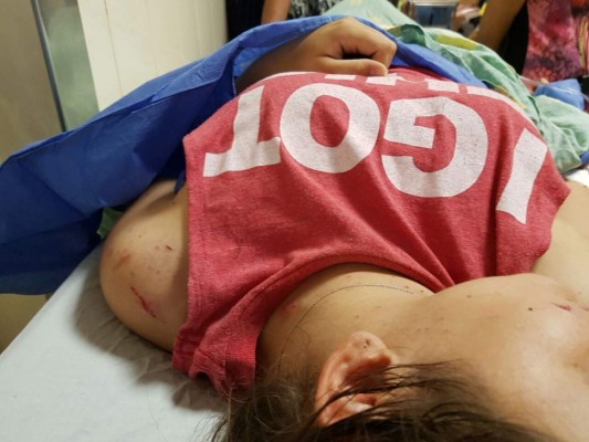 Joven resulta herida en asalto a bus en Tegucigalpa
