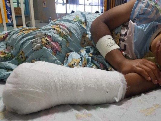 Una niña de 13 años, la primera víctima por pólvora en San Pedro Sula