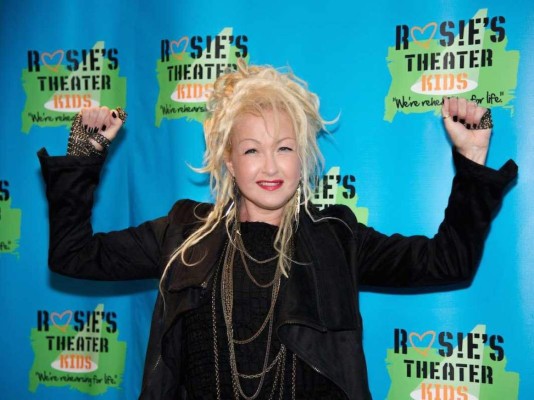 Cyndi Lauper habla de la psoriasis que padeció