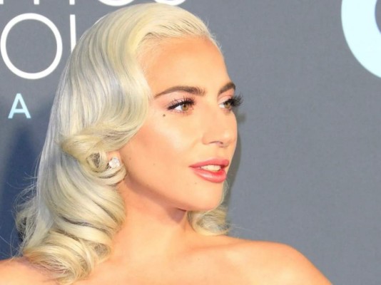 Se roban a los perros de Lady Gaga tras disparar al encargado de pasearlos