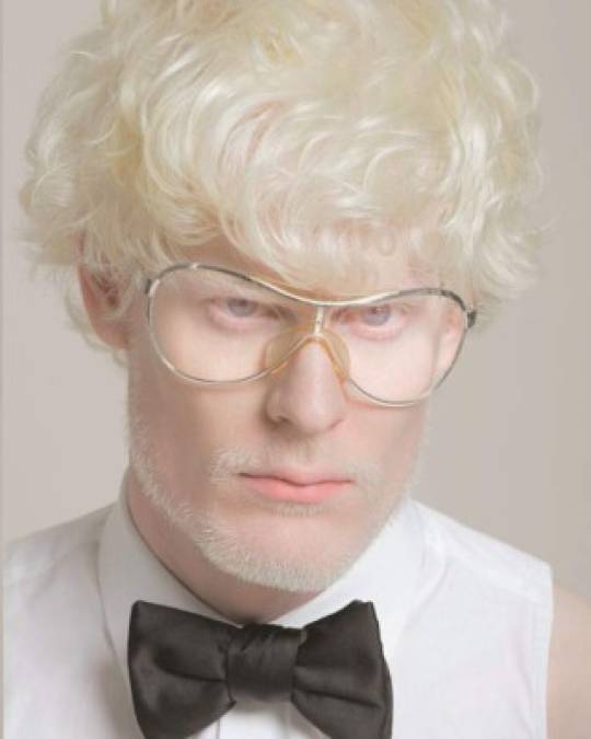 Stephen Thompson es un modelo albino, conocido por sus facciones perfectas y ojos azules con cabello rubio, un ángel como le dicen en el mundo del modelaje.