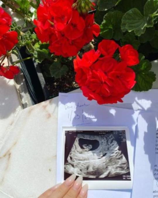 Con la ecografía Lana Rhoades oficializó su embarazo y reveló también que espera dar a luz el 13 de enero de 2022.