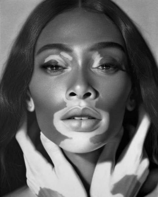 Winnie Harlow nació en el programa de EEUU 'America's Next Top Model', es embajadora de la enfermedad de vitiligo y su fama como modelo le ha dado un espacio en los ángeles de Victoria Secret´s.