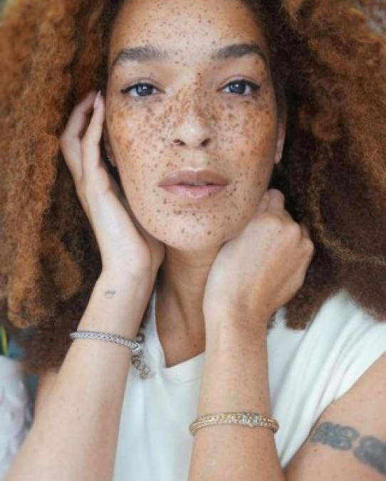 Nikia Phoenix adquirió relevancia por ser una chica negra con pecas, un rostro impresionante que redefine la belleza afro.