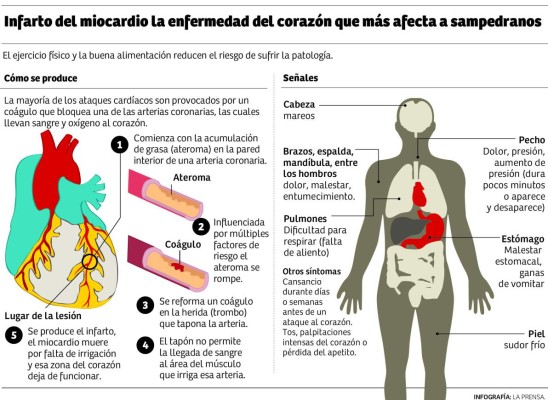 Foto: La Prensa