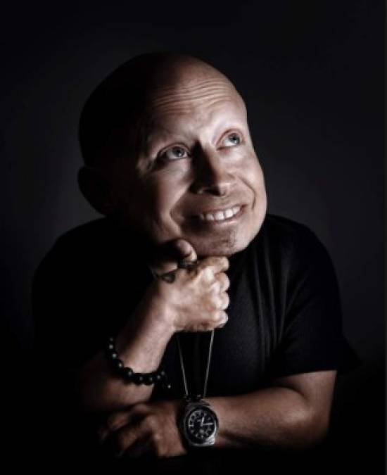 El actor estadounidense Verne Troyer, conocido por su papel de Mini-Me en las comedias cinematográficas de la serie 'Austin Powers', murió a la edad de 49 años el pasado 21 de abril.<br/><br/>Troyer, considerado como uno de los hombres más bajos del mundo, llevaba tiempo luchando con problemas de alcohol y ha comienzos de este mes tuvo que ser ingresado en un hospital del área de Los Ángeles, además tenía tendencias suicidas. <br/><br/>El actor que había nacido con el trastorno genético de enanismo, comenzó su carrera en el cine en 1994, primero como doble para un bebé de nueve meses, hasta que se lanzó a la fama en 1999 en la segunda película de la serie de 'Austin Powers'.<br/><br/>Verne había intentado superar su alcoholismo pasando por períodos de rehabilitación en varias ocasiones. En 2002 estuvo al borde de la muerte por intoxicación alcohólica.<br/><br/>