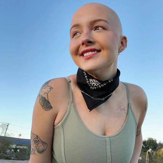 Muere joven tiktoker Maddy Baloy de cáncer en Florida