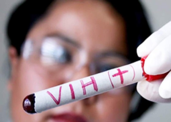 Cuatro de cada mil personas viven con VIH en Honduras