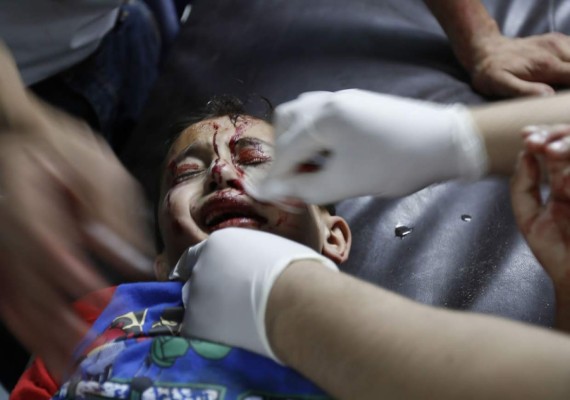 Los rostros del dolor en la Franja de Gaza; Niños los más afectados