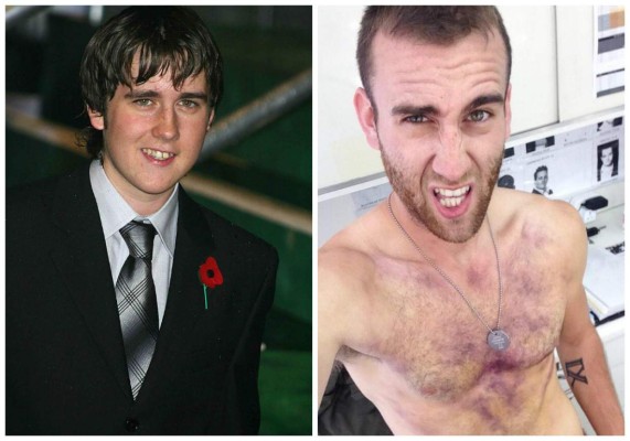 La transformación de Neville de 'Harry Potter'