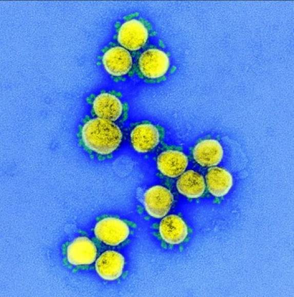 En las fotos se pueden observar también las partículas del virus aisladas.