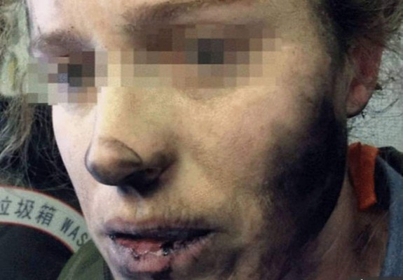 Mujer sufre quemaduras por explosión de auriculares en un avión