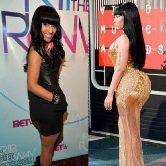 Minaj se habría hecho operaciones para agrandar sus caderas, sus glúteos y su busto, y en el rostro presuntamente se ha hecho cirugías en los dientes, aplicando bótox en mejillas y labios, y reconstruido su nariz, aunque al respecto la famosa dijo al medio Extra que en realidad se trata de un muy buen trabajo de maquillaje.