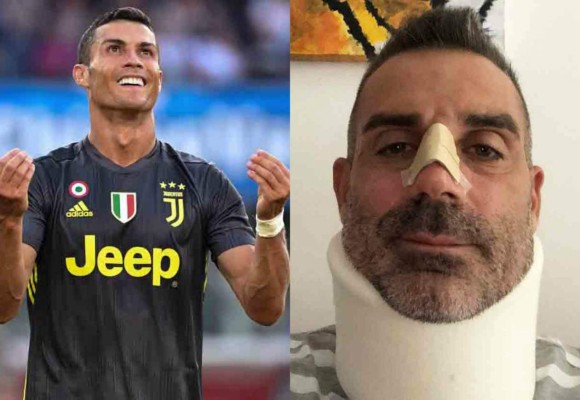 La sorpresiva acción de Cristiano Ronaldo tras romperle la nariz a portero italiano