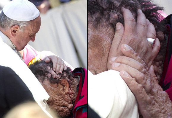 Abrazo y bendición de Francisco a enfermo conmueve catequesis