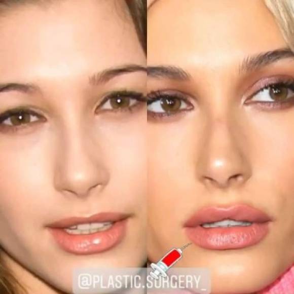 El enfado de Hailey también está ligado a las inseguridades que le han causado las comparaciones que se hacen de ella con ciertas exparejas de su ahora esposo, especialmente con la mediática cantante Selena Gómez.<br/>