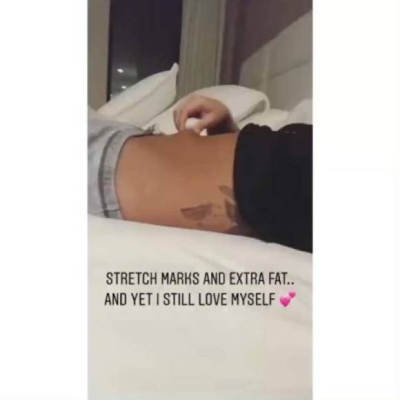 La estrella del pop haya sorprendido a propios y ajenos a lo largo de todo este tiempo publicando llamativas imágenes en su Instagram con las que exhibe orgullosa sus supuestos defectos físicos.