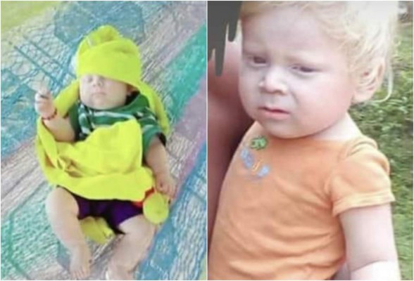 Un pueblo de Honduras veló por seis días a niño albino que 'revivía'