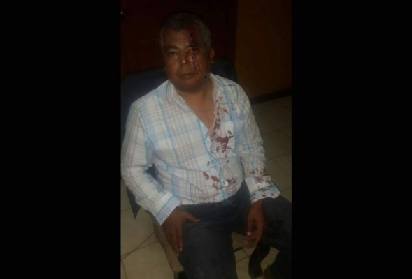 El comunicador Pablo Gerardo Matamoros fue auxiliado llevado a la estación policial de Belén para recibir atención médica.