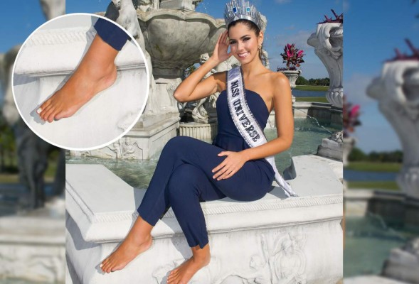 Bella, pero no de pies a cabeza. Al menos una uña le hace falta a la soberana. En las fotos de Paulina Vega, un día después de ser coronada, quedó evidenciado que le hace falta la uña del dedo meñique del pie izquierdo y que calza grande.