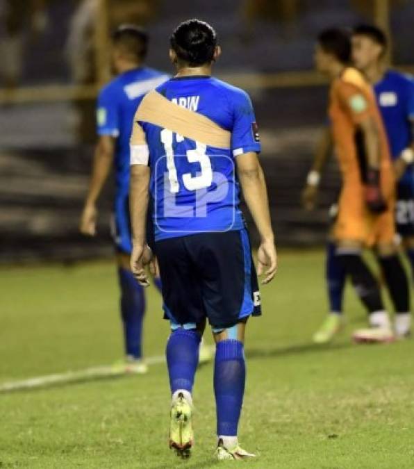 El defensa salvadoreño Alexander Larín sufrió un golpe y tuvo que terminar el partido con un vendaje.