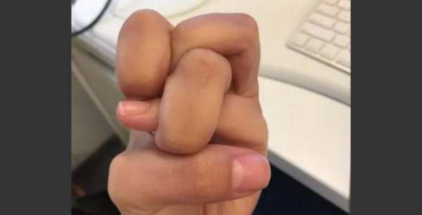 El nuevo reto viral de los 'dedos chuecos'