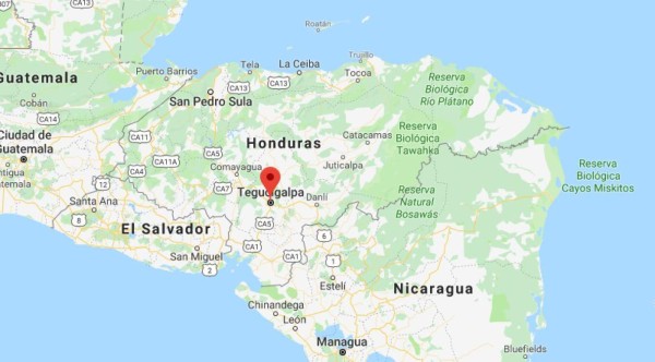 Niño de dos años sufre quemaduras con agua caliente en Comayagüela