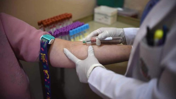 Dos vacunas contra el zika pasan prueba en laboratorio