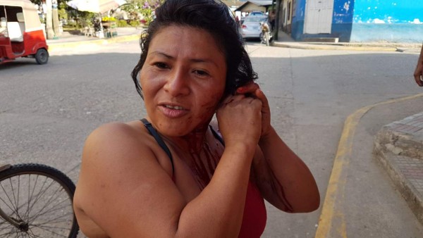 Mujer se cercenó una oreja asegurando que 'no le pertenecía'