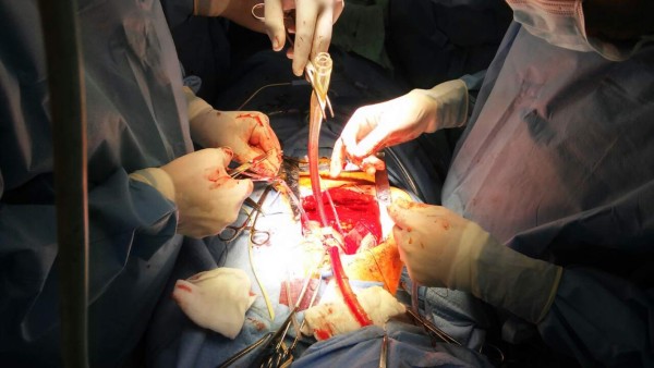Con éxito realizan primera operación a corazón abierto en el Rivas