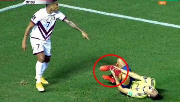 VIDEO: La espeluznante lesión que sufrió Santiago Arias en el Colombia-Venezuela