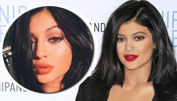 Kylie Jenner admite lo innegable: 'Me rellené los labios”