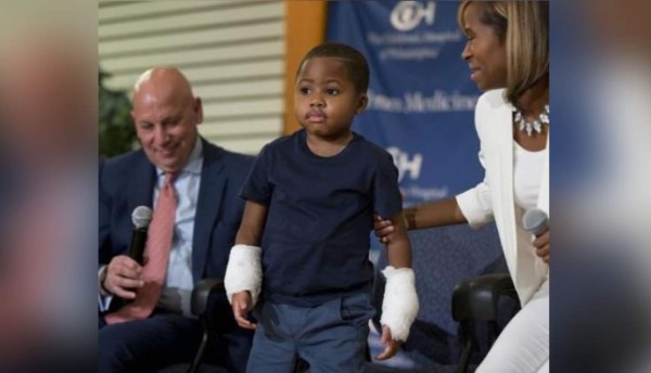 Trasplantan manos a niño de 8 años en EUA