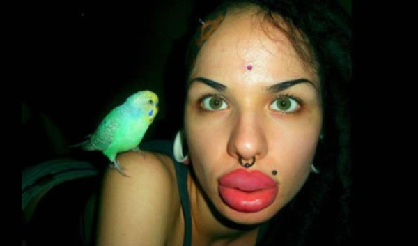 Mujer con los labios más grandes del mundo se ha operado 100 veces