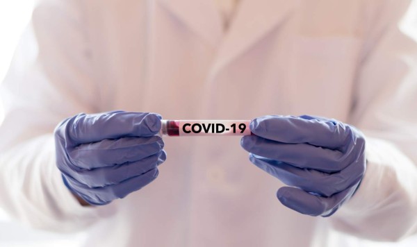Honduras realizaría estudios clínicos de posible medicamento contra el coronavirus