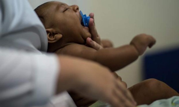 Nace primer bebé con microcefalia por zika en Nicaragua  