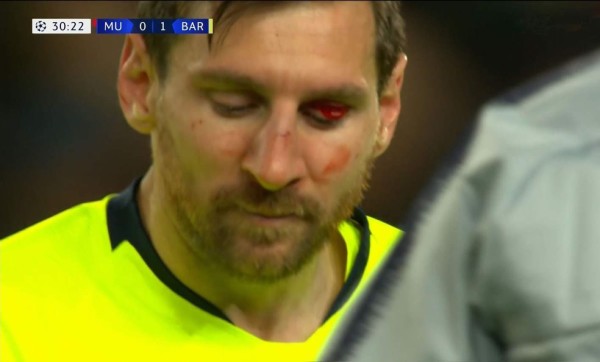 El duro golpe que hizo sangrar a Messi en el Manchester United-Barcelona