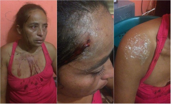 Hondureña es golpeada por sus hijas en Copán Ruinas