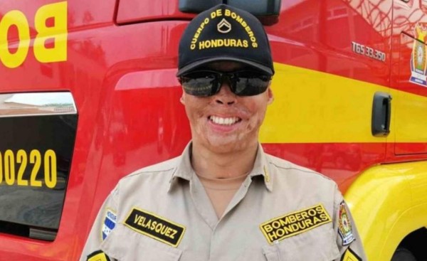 Bombero sobreviviente de La Montañita anuncia candidatura a diputado