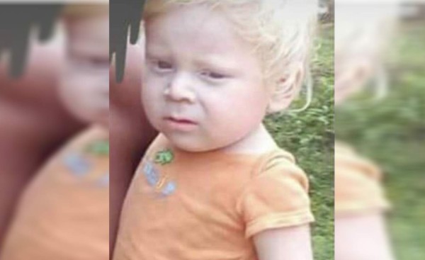 El niño albino nunca revivió, asegura doctora forense Julissa Villanueva