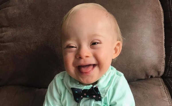 Bebé con síndrome de Down es el nuevo rostro de Gerber