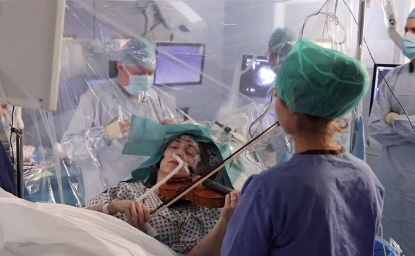Impactante: Mujer toca el violín mientras la operan de un tumor cerebral