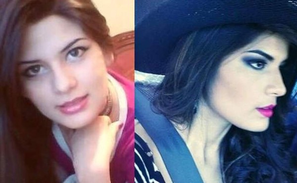 Muere miss ecuatoriana cuando se sometía a cirugía estética
