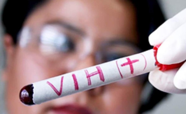 Continúa búsqueda de vacuna contra VIH tras fracaso del último ensayo