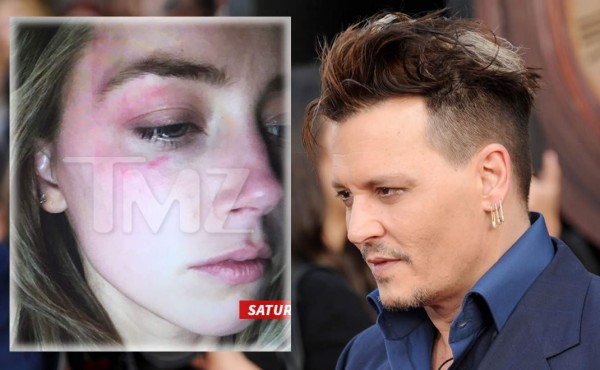 Amber Heard dice que Johnny Deep la golpeó