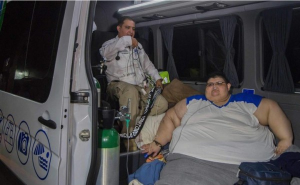 El hombre más obeso del mundo será operado en México tras perder 175 kilos