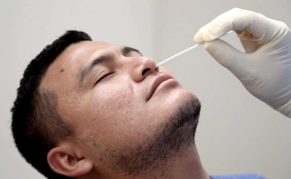Salud comprará 300,000 pruebas de antígenos para detectar casos covid