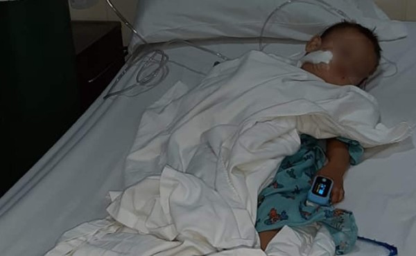 Niñito de dos años es atacado a machetazos por su tío en Omoa